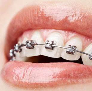 Roehm Stephen DDS:Midwest Orthodontic Associates